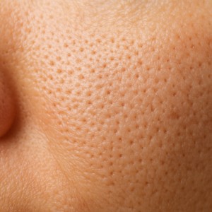 علت باز شدن منافذ پوست و راه‌های درمان آن